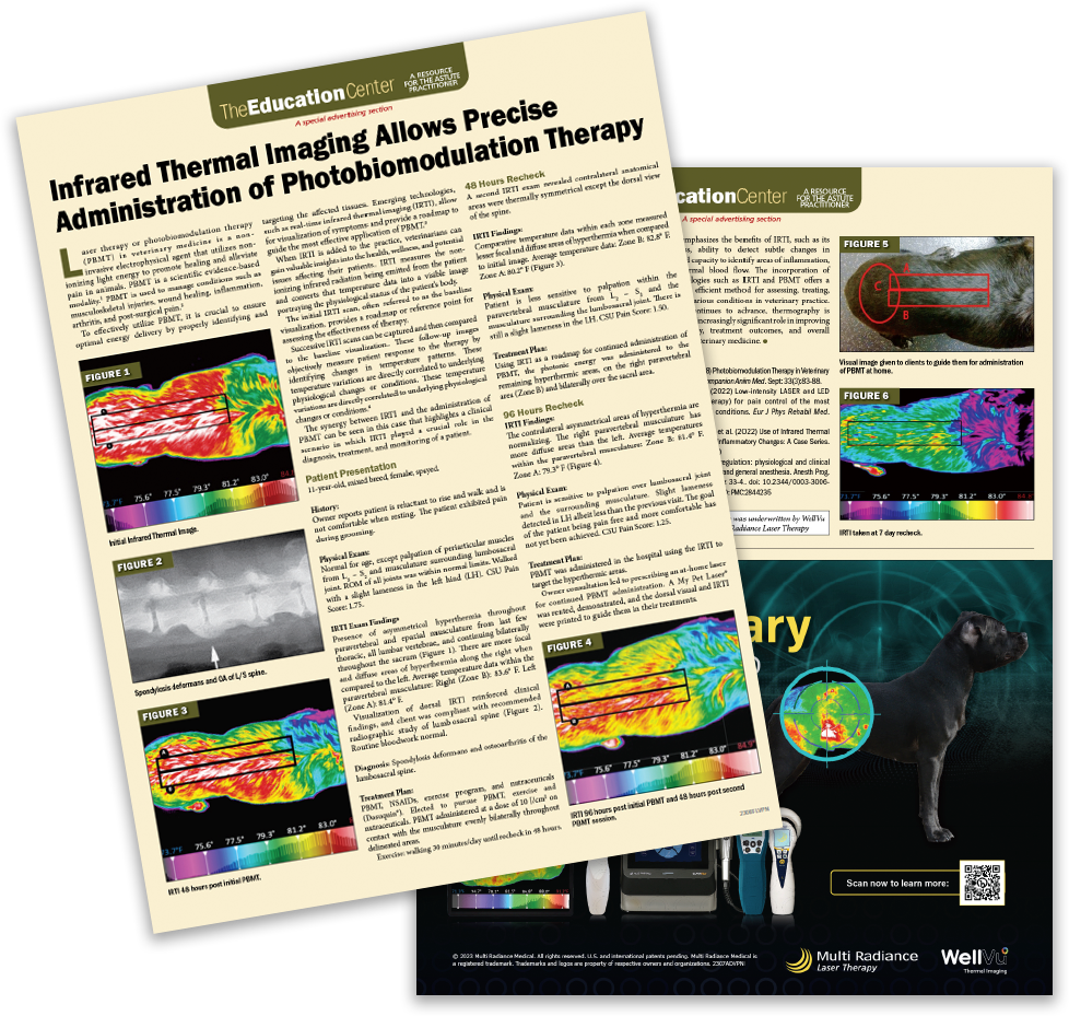 IRTI Allows Precise Administration of PBMT Article Thumbnail